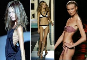 Anorexia